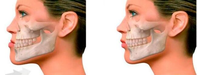 a9lSp7okBzOoyrAiOaN78XhxTrj2x6yS1QONdeJT